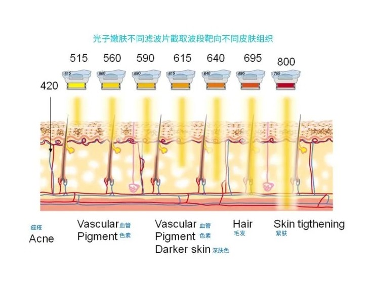 五大光子嫩膚技術(shù)（IPL、DPL、OPT、APT、BBL）及濾光片區(qū)別